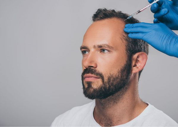 Seattle Man receiving PRP injections for hair replacement.